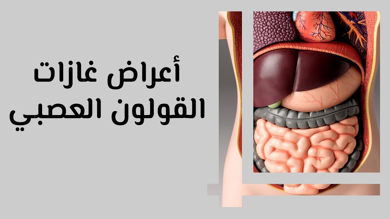 علاج غازات القولون العصبي - تخلص من غازات البطن بهذه الطريقة 1751