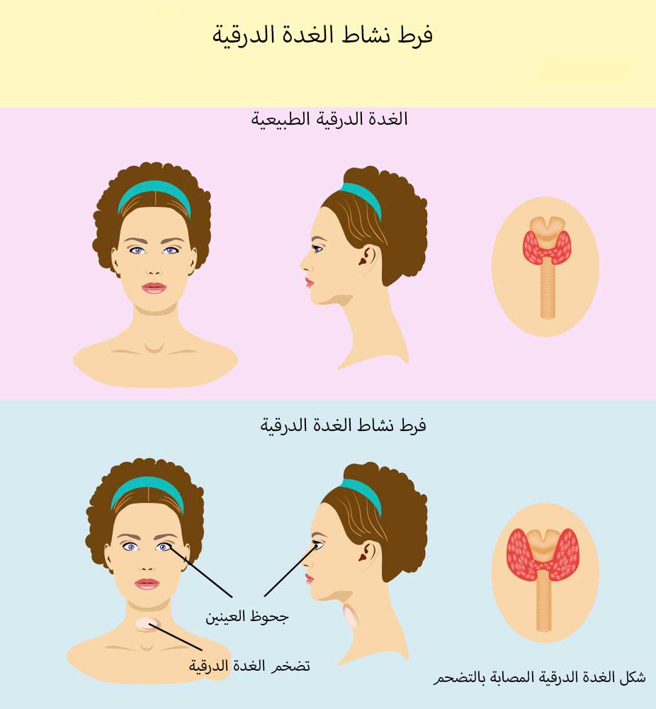 صور الغدة الدرقية - لن تصدق شكل الغدة الدرقية سبحان الله 1666 11