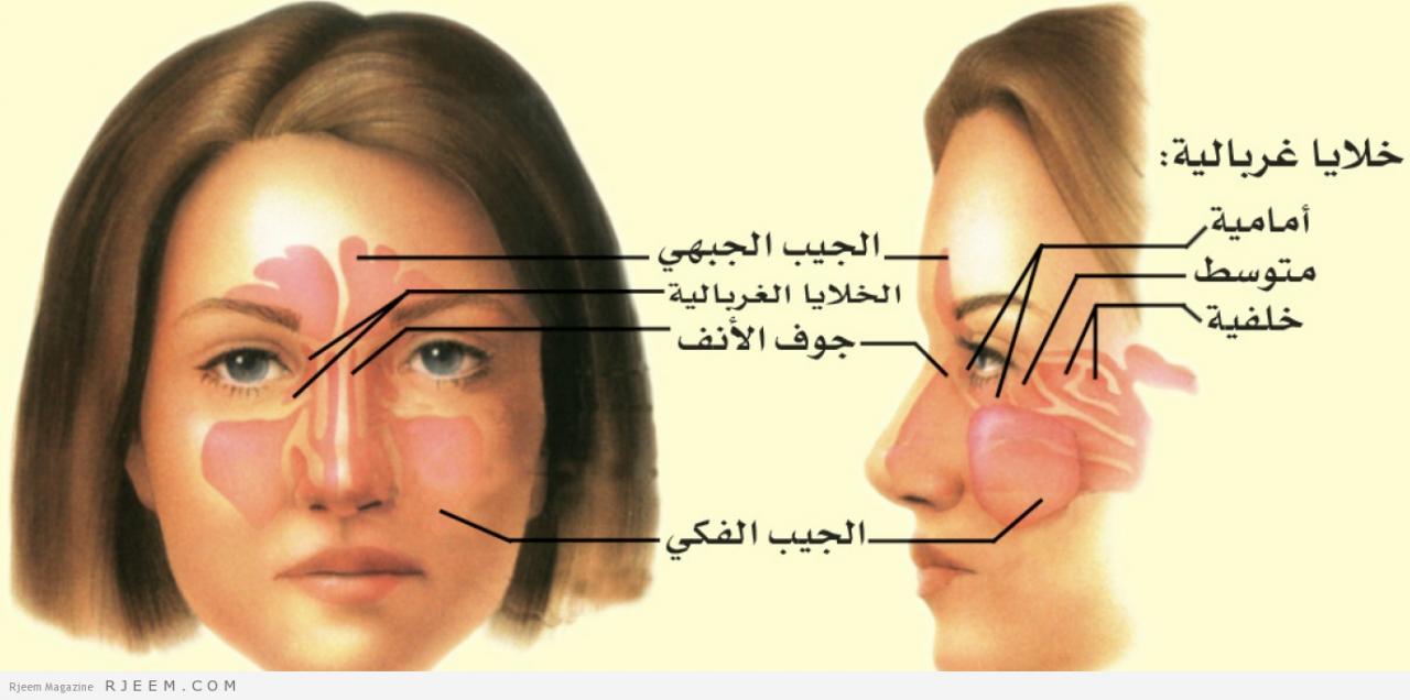 اسباب الصداع الشديد , تخلصي من الصداع في دقائق