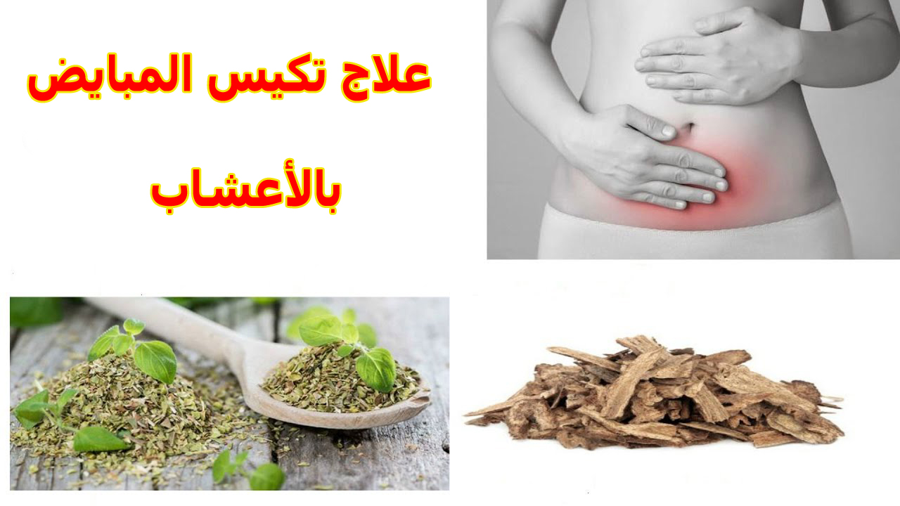 لعلاج تكيس المبايض سهل - تكيسات المبايض وحش يهدد امومتك 6236 3