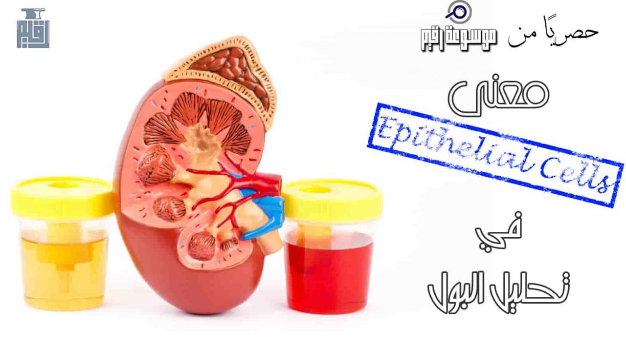 معنى Pus Cells، من أهم التحاليل 338 1-Jpeg