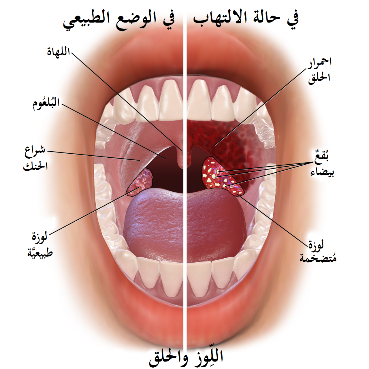 اسباب مرض الدفتيريا - من الامراض مخيفة 1068