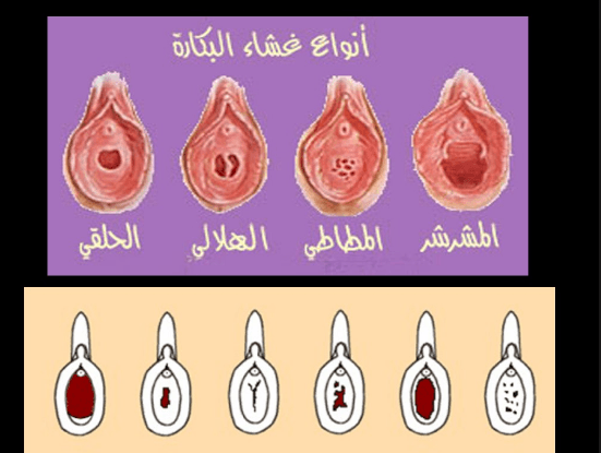 كيف اعرف اني بنت - اكشفى عذريتك فى المنزل بدون طبيب 3640