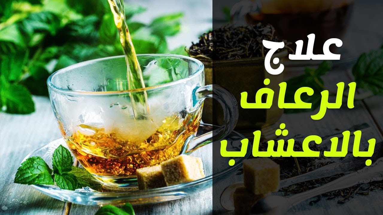 علاج الرعاف نهائيا , ما هو الرعاف