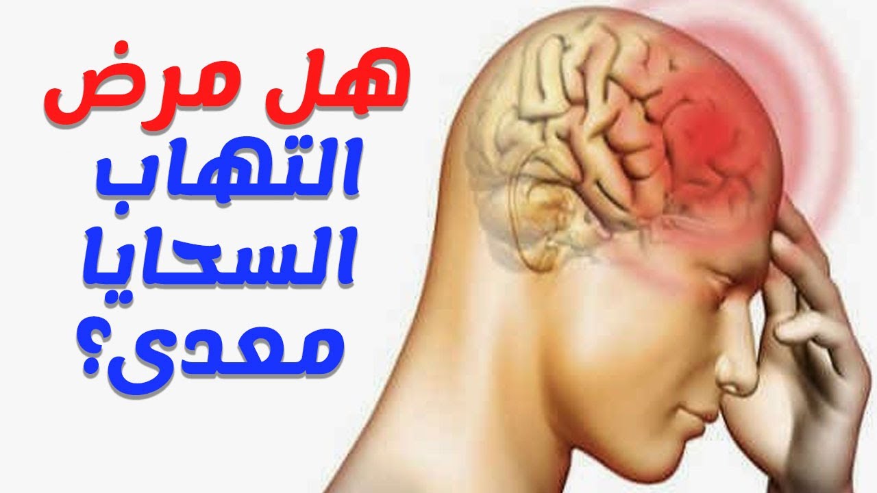 التهاب السحايا هل هو معدي , يهم الكثير منا