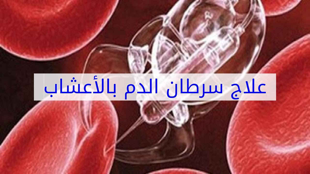 ماهو علاج سرطان الدم - من ابشع الامراض 3081 1