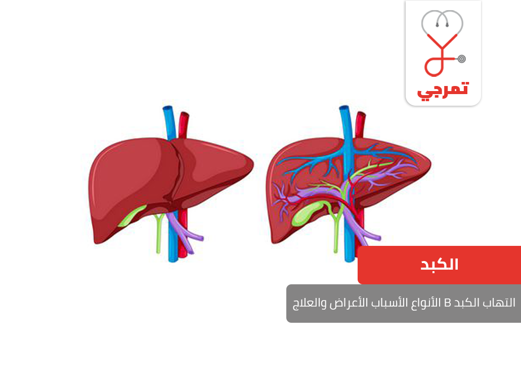 علاج الكبد الوبائي - افضل علاج للكبد الوبائي 1445 1