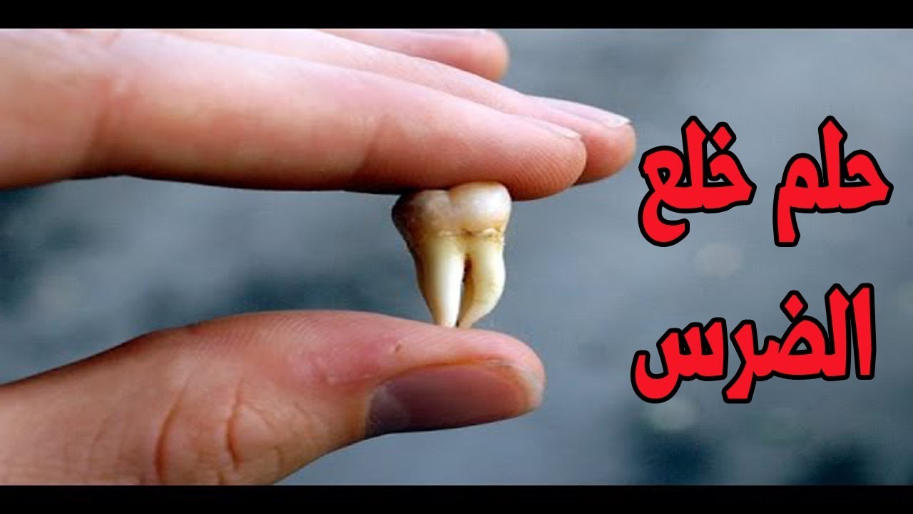 تفسير خلع الضرس في الحلم - خلع الضرس في المنام لا يعني شر