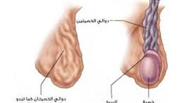 اعراض دوالى الخصيتين-لو الاعراض دى عندك لازم تقلق 3879 1