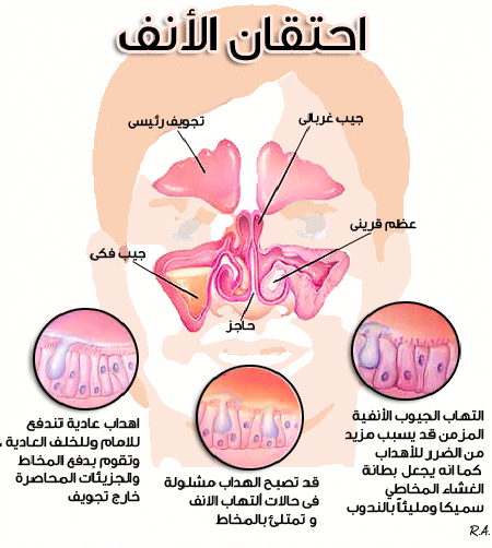 افرازات الانف الخضراء- اعراض الالتهاب بالجيوب الانفية 212