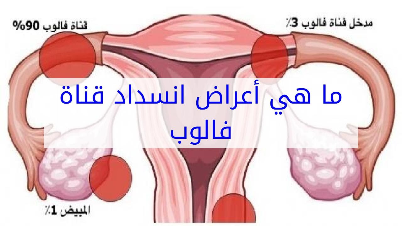 اعراض انسداد قناة فالوب , علاقة قناة فالوب بالدورة الشهرية