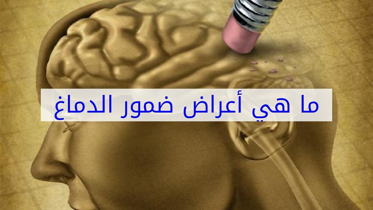 اسباب ضمور المخ - يحدث لبعض الاطفال 6347 2