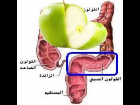 اعراض القولون الهضمي بالتفصيل - كيف تعرف انك مريض بالقولون 3225 2